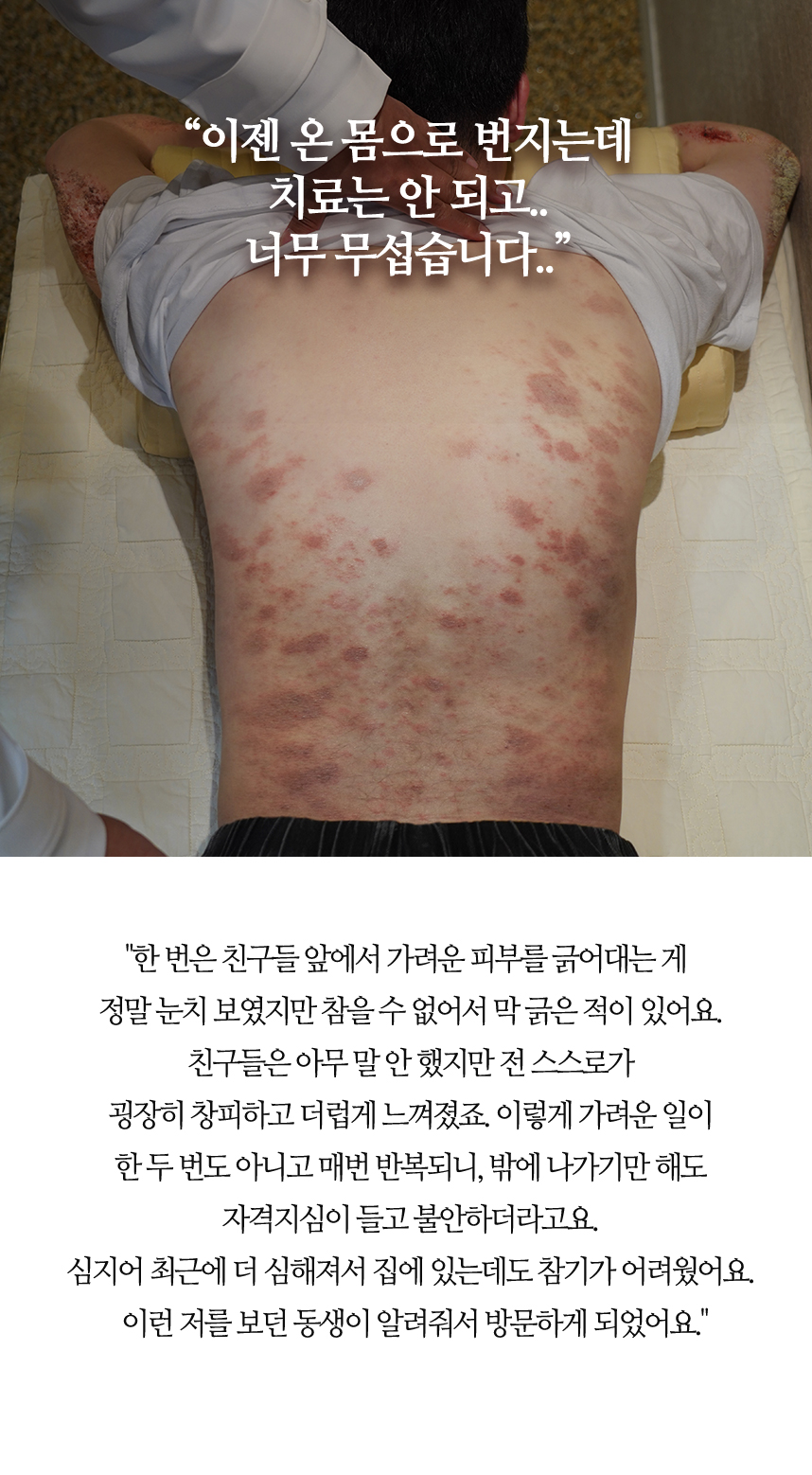 이젠 온 몸으로 번지는데 치료는 안되고 너무 무섭습니다.