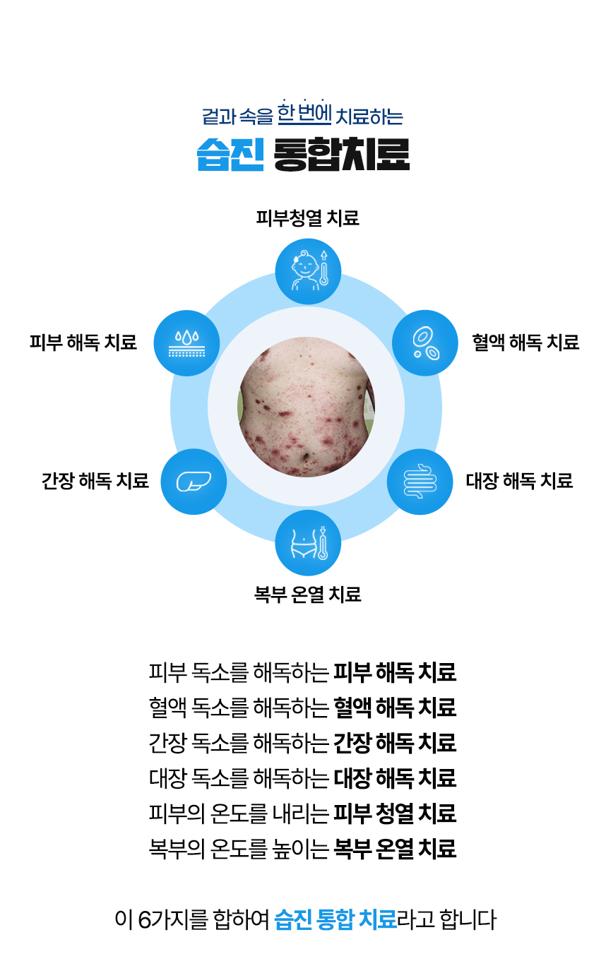 겉과 속을 함번에 치료하는 습진 통합치료 / 사중독소 장독소, 간독소, 혈액독소, 피부독소 사중독소의 4중 해독 치료 피부, 피부의 열을 내리는 피부 청열 치료, 복부의 온도를 높이는 복부 온열 치료