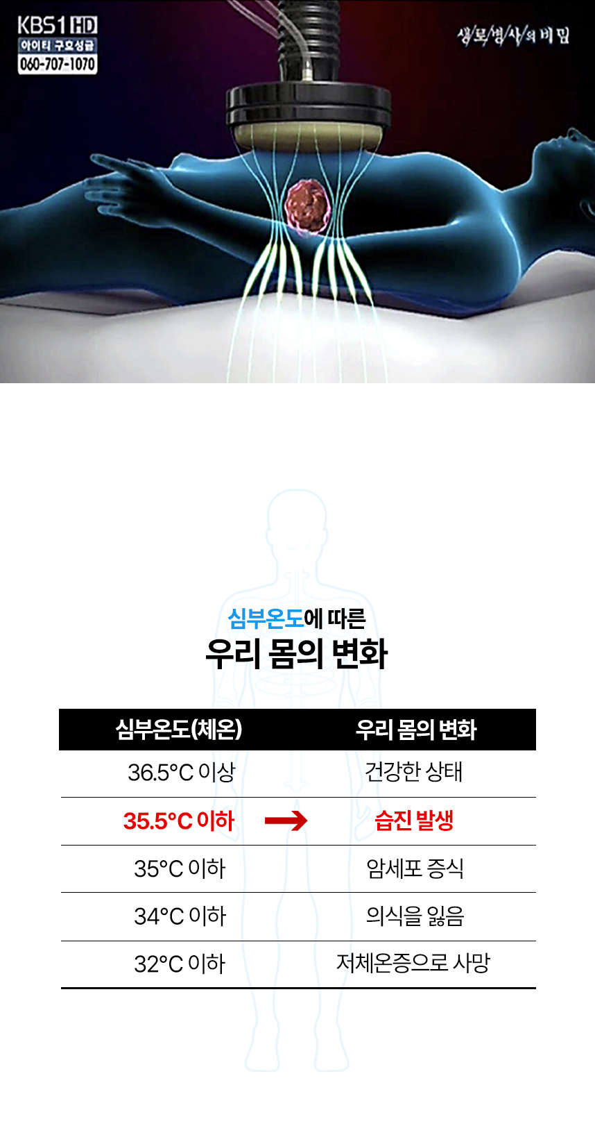 심부온도에 따른 우리 몸의 변화 표. 35.5도 이하인 경우 습진 발생.