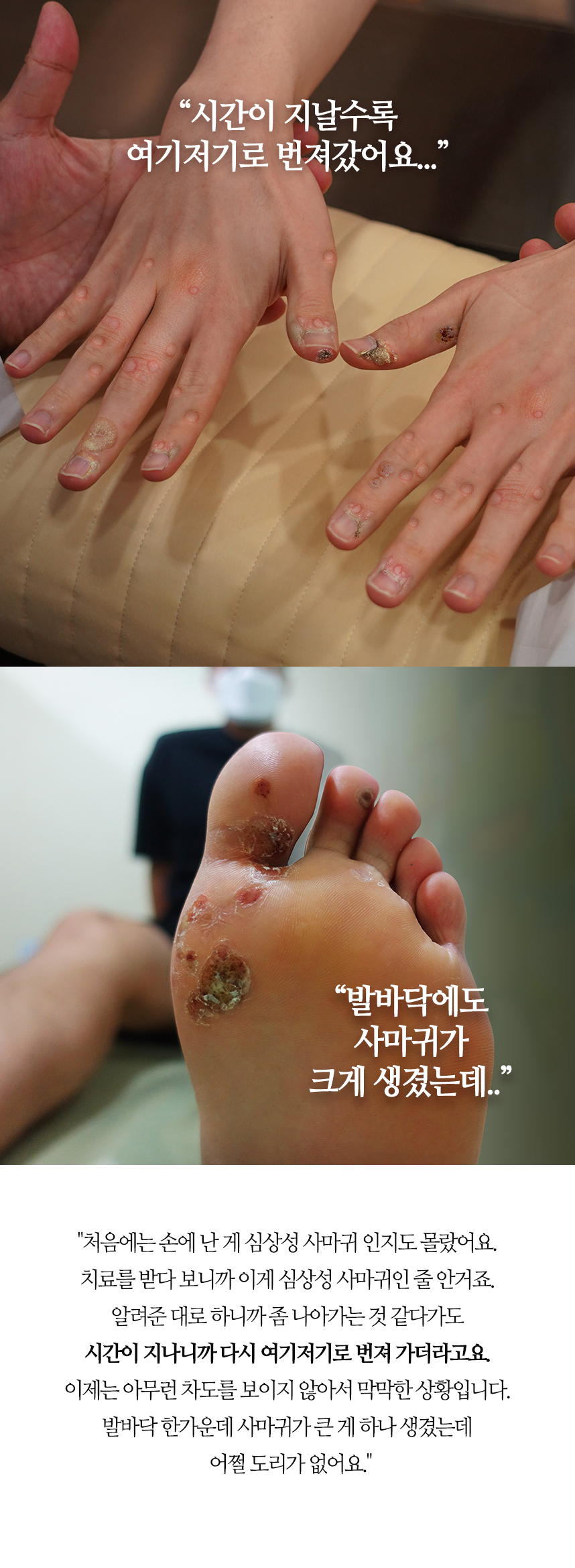 시간이 지날수록 여기저기로 번졌어요