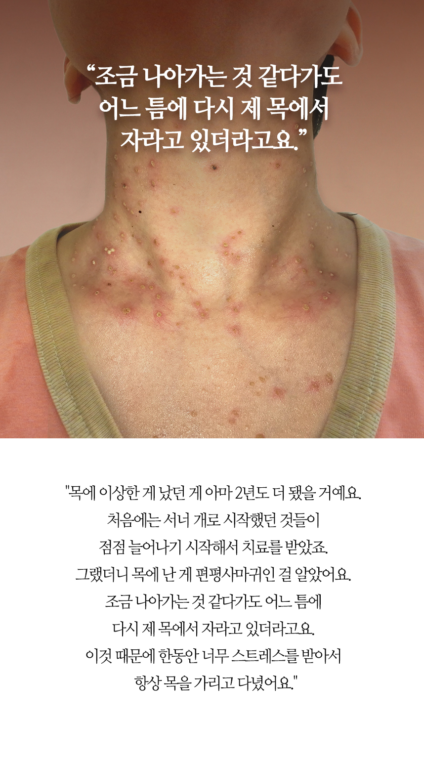 조금 나아가는 것 같다가도 어느틈에 다시 자라고 있더라고요