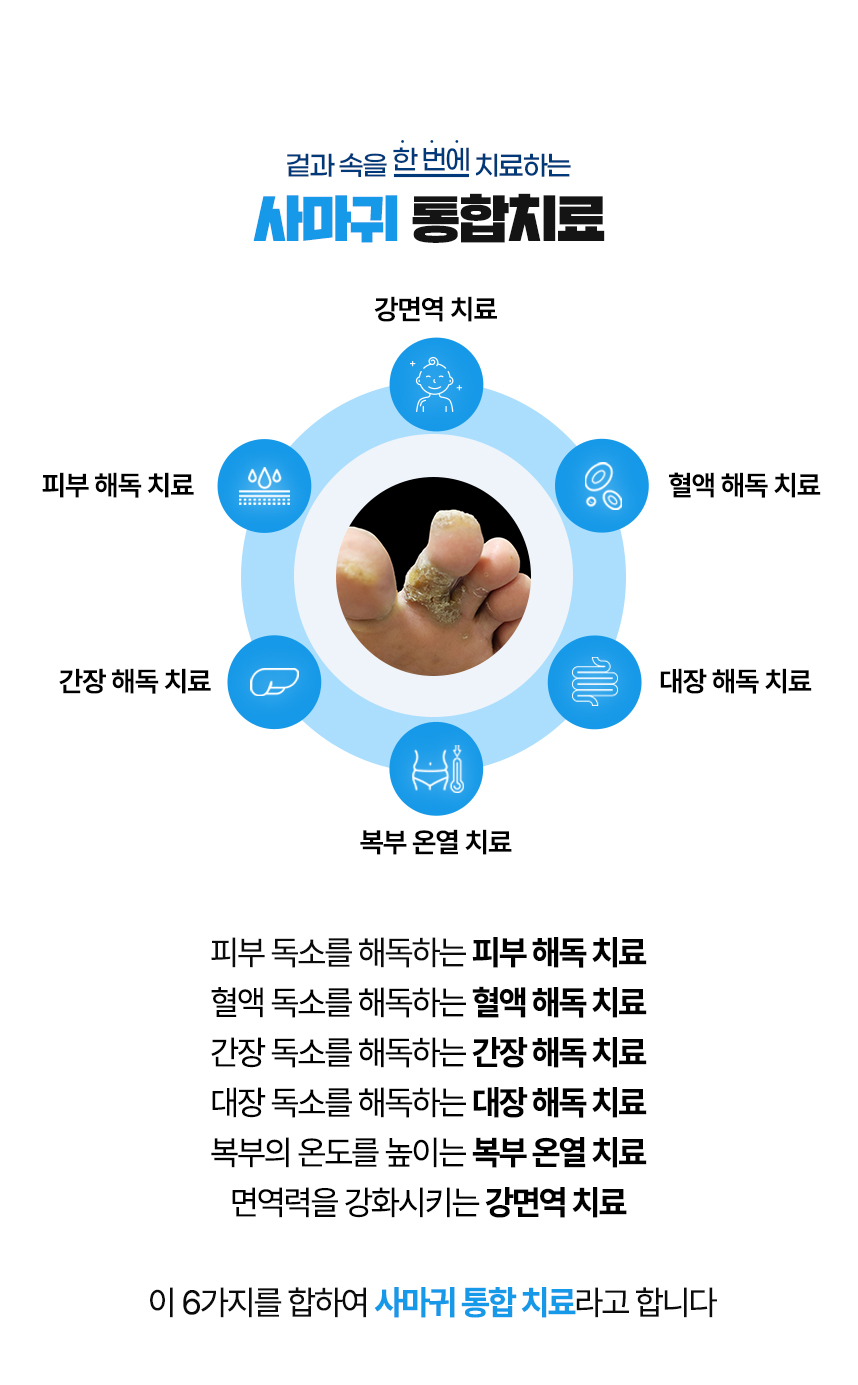 겉과 속을 함번에 치료하는 사마귀 통합치료 / 사중독소 장독소, 간독소, 혈액독소, 피부독소 사중독소의 4중 해독 치료 피부, 피부의 열을 내리는 피부 청열 치료, 복부의 온도를 높이는 복부 온열 치료