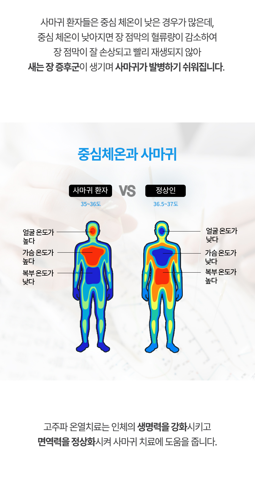 중심 체온이 낮아지면 장 점막의 혈류량이 감소하여 장 점막이 잘 손상되고 빨리 재생되지 않아 새는 장 증후군이 생기며 사마귀가 발병하기 쉬워집니다. 고주파 온열치료는 인체의 생명력을 강화시키고 면역력을 정상화시켜 사마귀 치료에 도움을 줍니다.