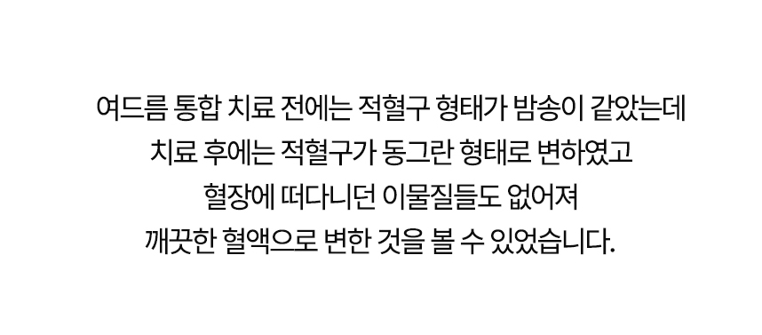 치료 전에는 적혈구 형태가 밤송이 같았는데 치료 후에는 동그란 형태로 변했고 혈장에 떠다니던 이물질들도 없어져 깨끗한 혈액으로 변한 것을 볼 수 있었습니다.