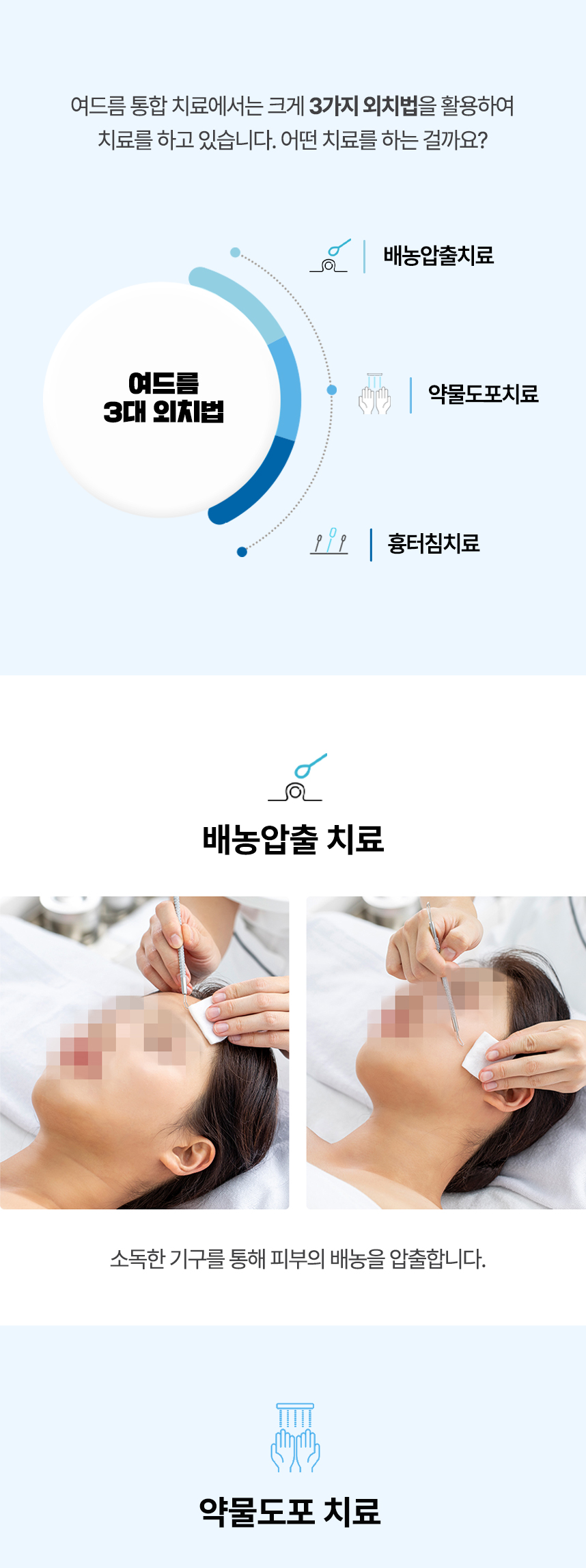 여드름3대 외치법