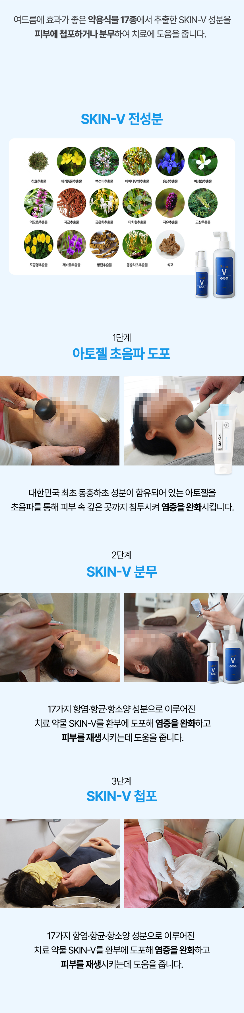 약물도포치료