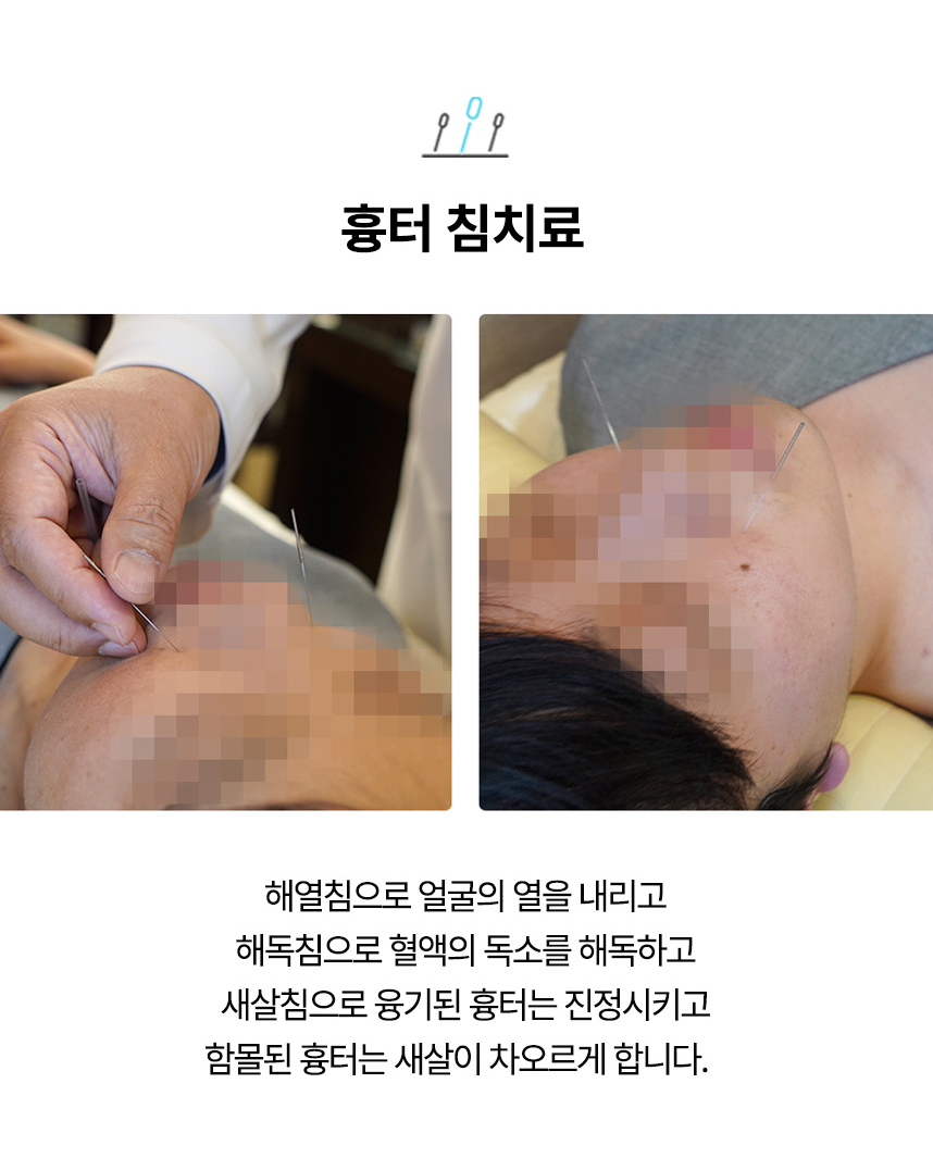 치료법 