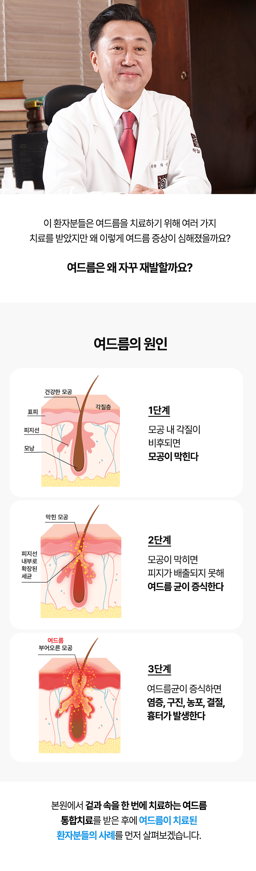 다양한 부위별 여드름 사례