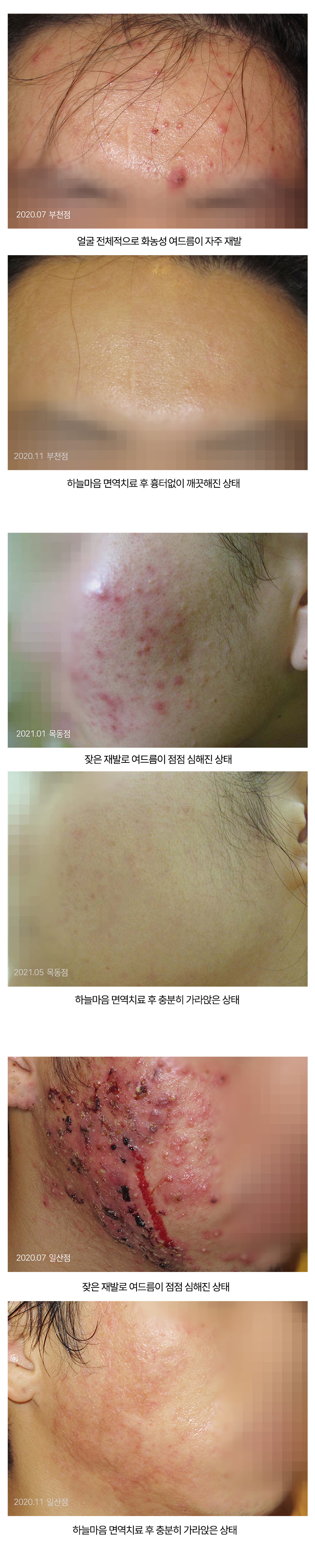 치료전후 이미지2