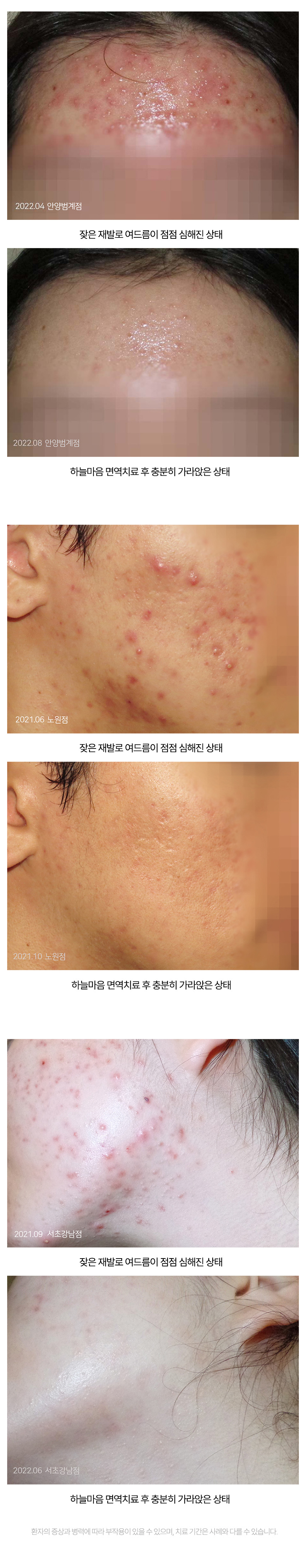 치료전후 이미지3