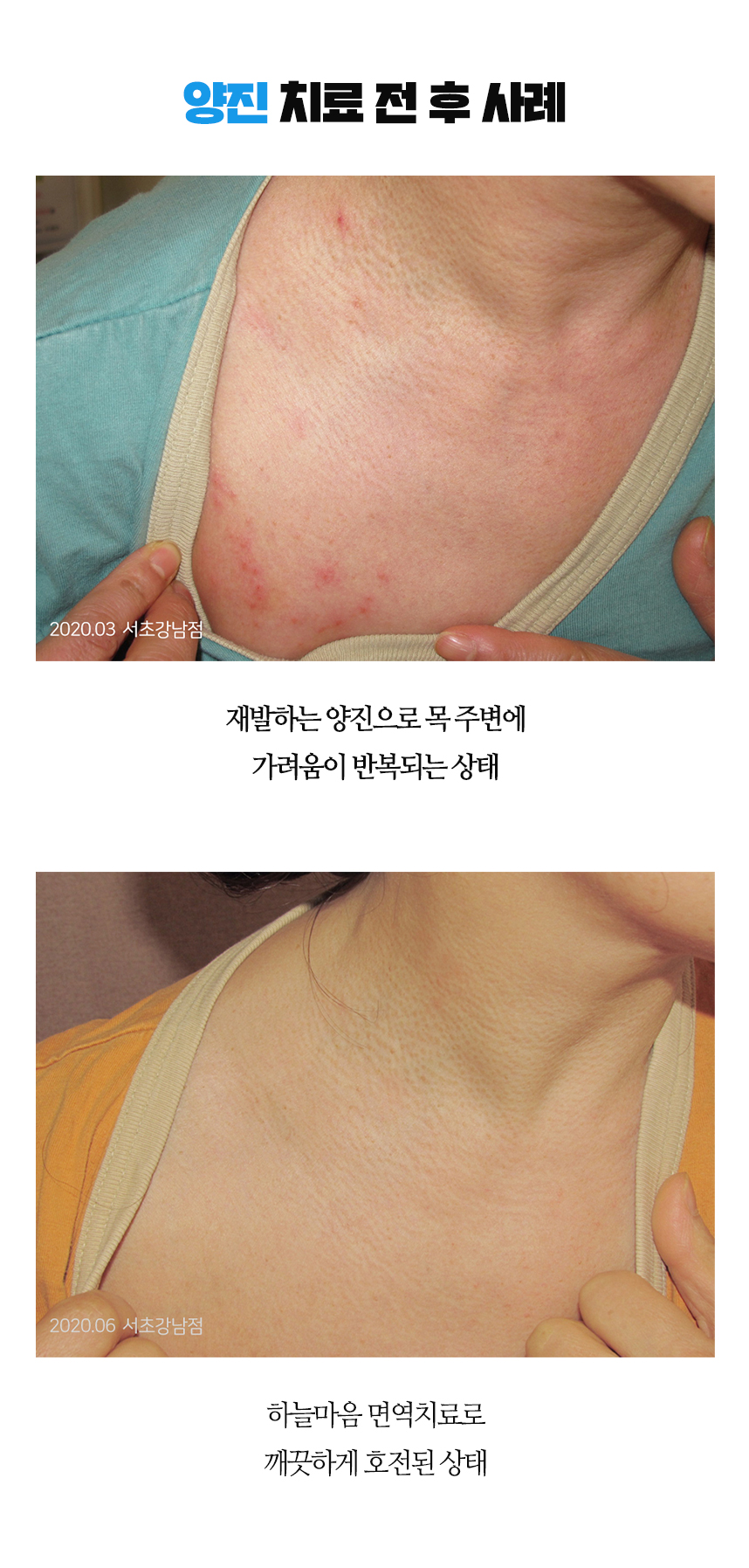 치료전후 사례