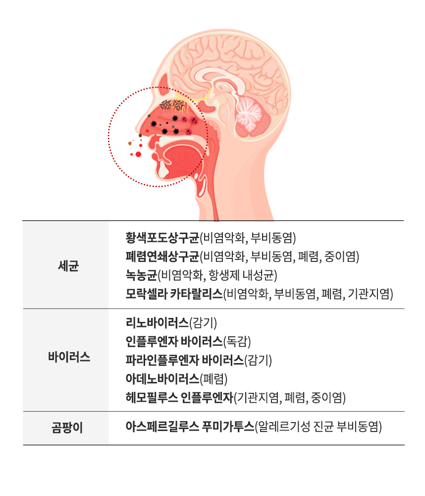 세균, 바이러스, 곰팡이 종류