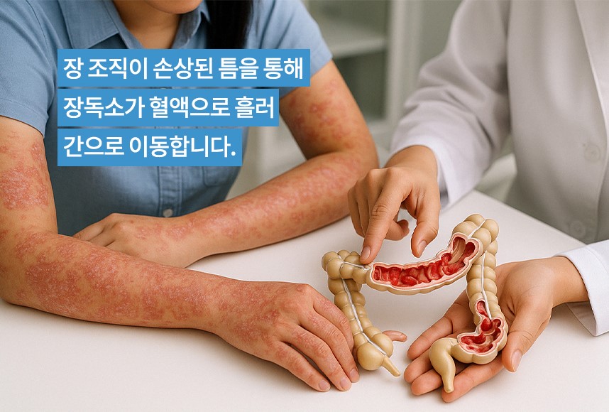 건선의 원리에 대해 설명하는 하늘마음한의원 한의사 