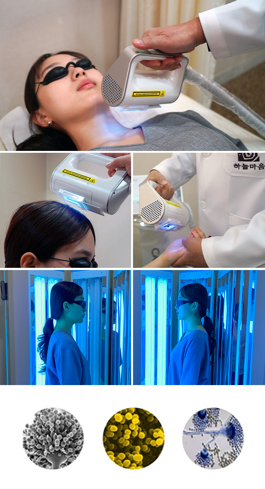 광선치료를 받는 건선환자