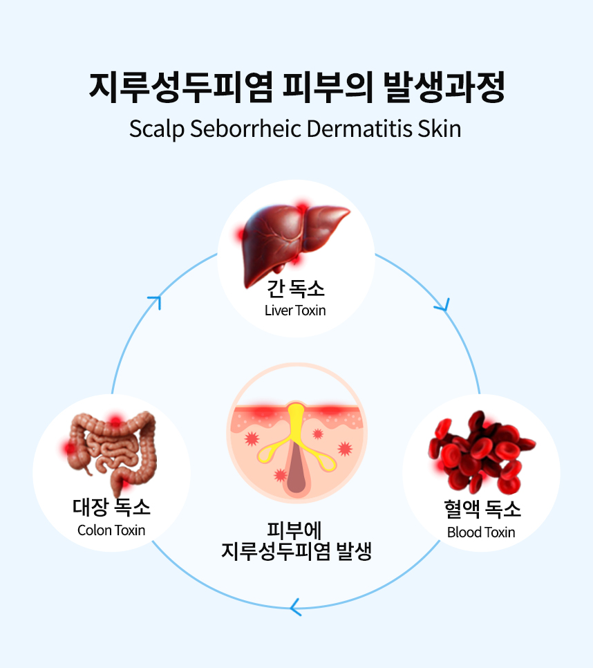 지루성두피염 피부의 발생과정