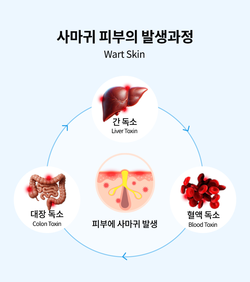 사마귀 피부의 발생과정