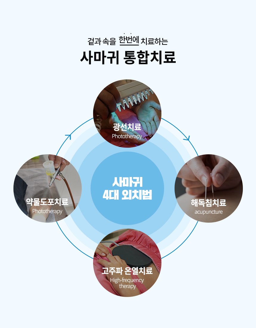 통합치료