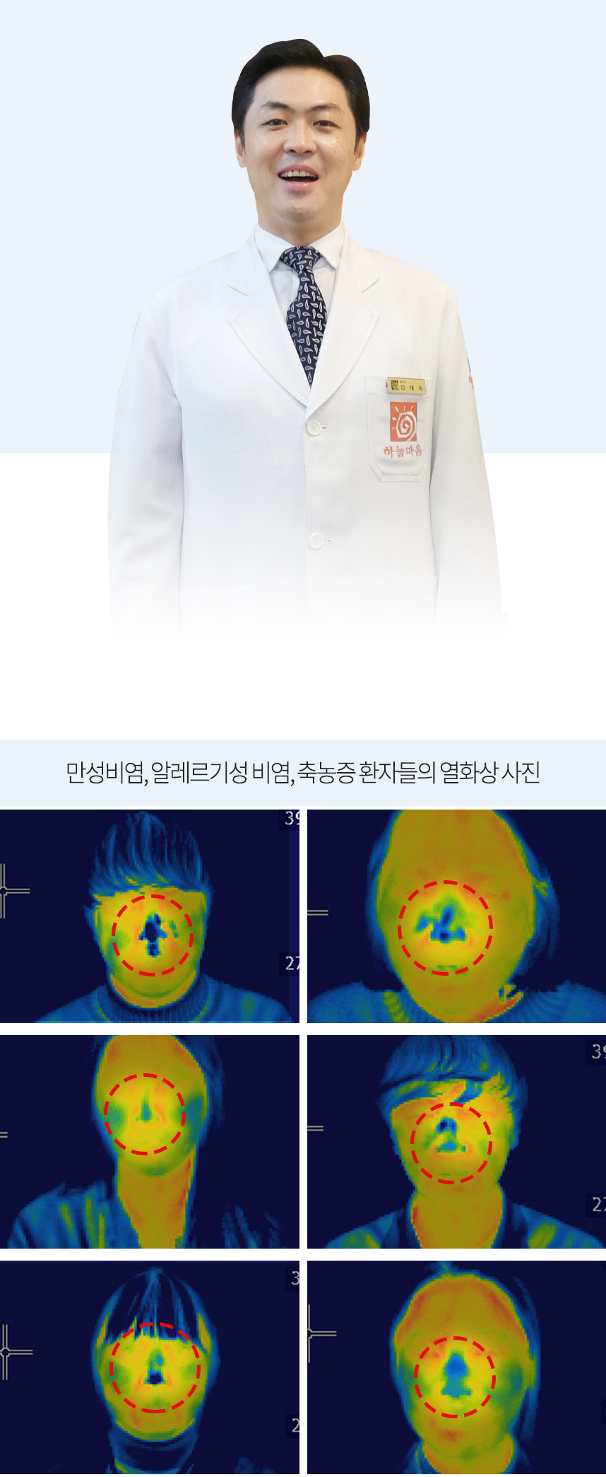 하늘마음은 코와 폐가 차가워서 발병한다고 보고 있습니다.