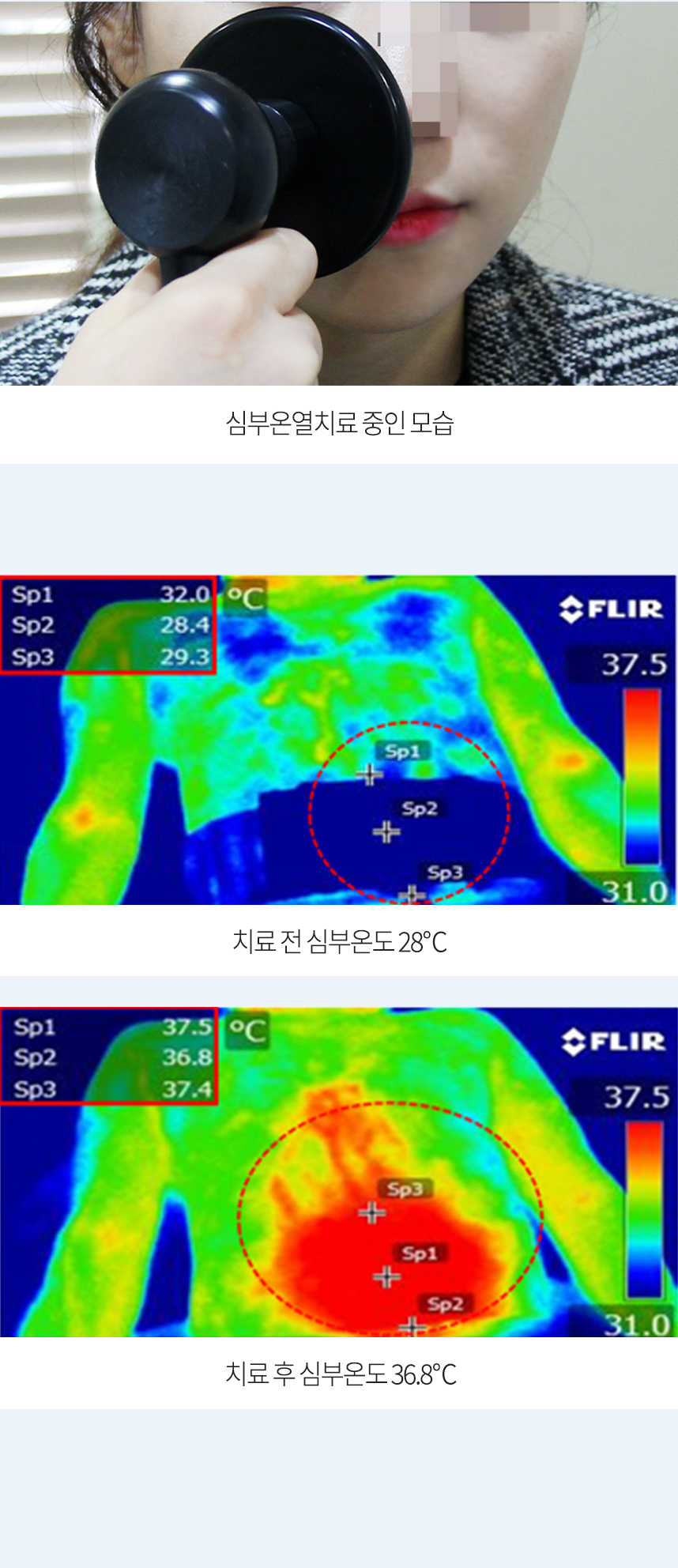 첫번째로 심부온열을 높이는 것이 중요합니다