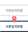 지루성 피부염